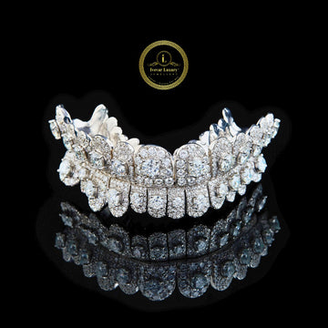 Custom Symmetrical Top and Bottom Dental Caps Featuring Raised Lab Diamonds