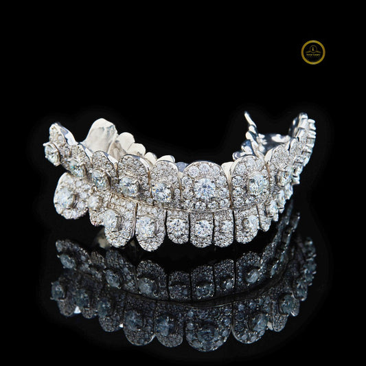 Custom Symmetrical Top and Bottom Dental Caps Featuring Raised Lab Diamonds