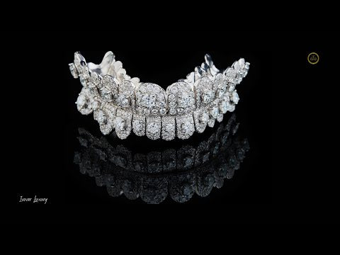 Iced-Out Diamond Grillz – Full Custom Luxury Mouthpiece by Ivevar